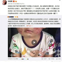 ���ܾ���΢��ŭ����Ů�˲�����������