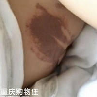 1����ͯ�����Ķ�Ƥ�����ˡ��������ݳ����˵���4ǧ