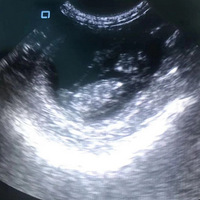 ���ƺֱ�۴��Сè����ʺ��