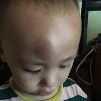 ���ߴ��ֻ��߿����ʹ����Ҽ�ɲ���޶�ײ�˸��������������š�