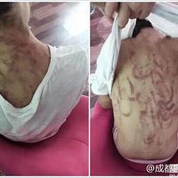 12��Ůͯ����ĸŰ����Ѫ����һƬ����������������������..