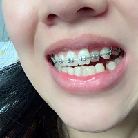 ӣ23ڿʼˣ200
