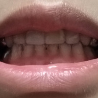 �޶�һ������ȥ��ǻҽԺȫ�鲹��