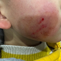 3���׶��������˻��ݣ��Ҹô�����ȥ�ĸ�ҽԺ���������׵�����