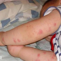 2�꺢��Ϳ���;���ɥ����������ý��£��ҳ���һ��Ҫ֪����Щ��