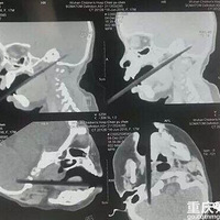 һ��Ҫ���ע�⣬����С��һ����һ������Щ����