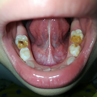 ����200�鲻����ʱֹ���ͯȣ��