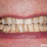 �������ݷŴ�1000����ͼƬ�����ӿ����ҾͲ�������ˢ����