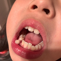 Ϊ���޶�����Է������㣬����������¡���