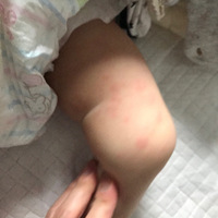 �޶�ͻȻ���ܶ�������ô�찡��