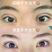 ˫Ƥ޸һ꣬ڰץ˫Ƥ޸ɹˣ