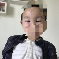 ˣҺ޶һó涷Ƕ¡ûռǡ