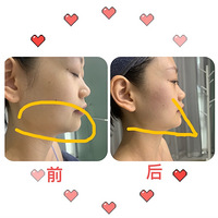Dehoor淺沿V