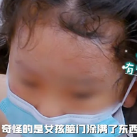 ׵ͯҽƼ¼Ƭˣֻ֮˵һ䣺ŹӰ