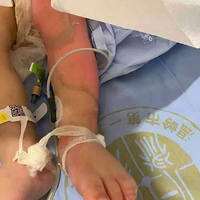 ʹģ1ضˣICUȣ̿޳ˣ