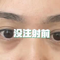 ҽ|èṵе