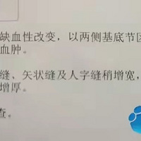 ְ־ٸ߸ˤICUӤβΣ֪ͨ飡ϣ