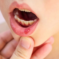 16ŮڴȥҽԺ飬ΪȾHPV
