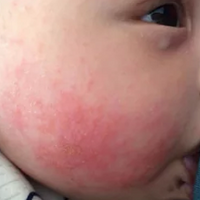 5Ӥ䡰ͷޡ˪ع⣺90%趼