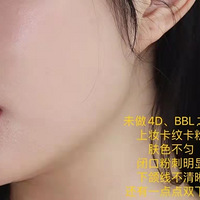 ҽ񫣬ڶBBLFotona4D