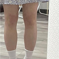 �Ա�ͼ���ߴ�ң��߸�Ь����С�ȴֵ�Ů���ж���Ҫ��