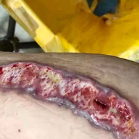 ����ܰ�����ĸ�̾