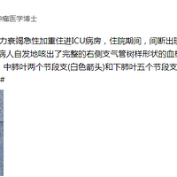 36�����ӿȳ������β�Ѫ˨���������һ����������������������