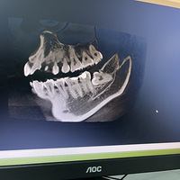 �ϻ���Ȼ˵�úá���ʹ���ǲ���������Ҫ������һ��Ҫ��ʱ��ҽ��