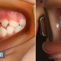 ں󣬶סݣѪʷ......