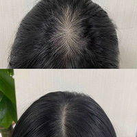 �����ҵ�����ģ��ڷ�+���ü��һ�꣬���춼������