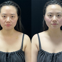뵺ȫѵʦβģһεı仯ж