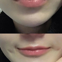ʱ1꣬ҽĿȥdo˴