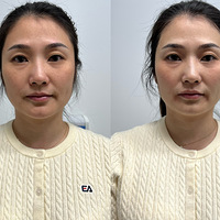 489Ԫ7ΣDPLڽ𳬹+ˮˮ+ˮᣡɫʶı