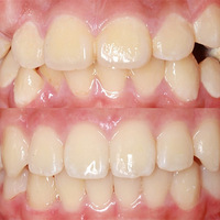 ݽһҪѡ䣡ܴﵽ°빦Ч