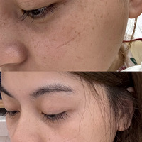 ���1�� | ̸̸�������