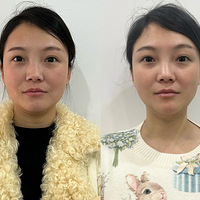 ��ʯ������������׵�������������һ�Σ��о���������10��