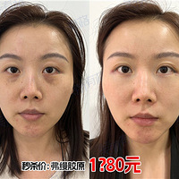 ��è��780�����Ͻ�ԭ1��80������꿨1980��������3800