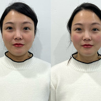 ����+����+ȥ����������Ҳ�ܾ����沿�������ؼ����治ʹ