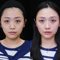 ������������ֵ�ķ�����biu������ĺ���Ȼ�����ָ߼�������