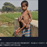 ������ֲ������� �к����������������ȣ�ͼ��