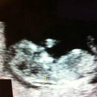 �������ڰ���������ҽԺ�뱦������Щ����