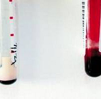 [ת]�Գ����Ĳ�������ʳ�ķ���Ԥ����