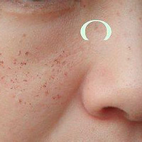 ����ȥ�ˣ��ҵĶ��꿹���¼���