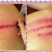 Ϊ�˶���,��Ѫ,ϴ��ȫ����,����ȥ��