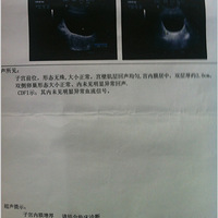 ���汣�ӣ�ǧ������С���ָ��