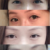 ����Ƥ��˫��Ƥ���������������� ��ͼ��