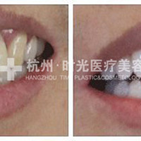 ʱ�ⴺ�������ػ��ײͿ��ſ���������ݹ��Ű���