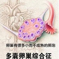 �����ѳ��ۺ�֢����ô���£�����ô���ƣ�