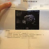 �������ֱ�����һ�Բ�����裬�����໥��������