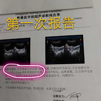 �ӹ��������� �������ʹ��